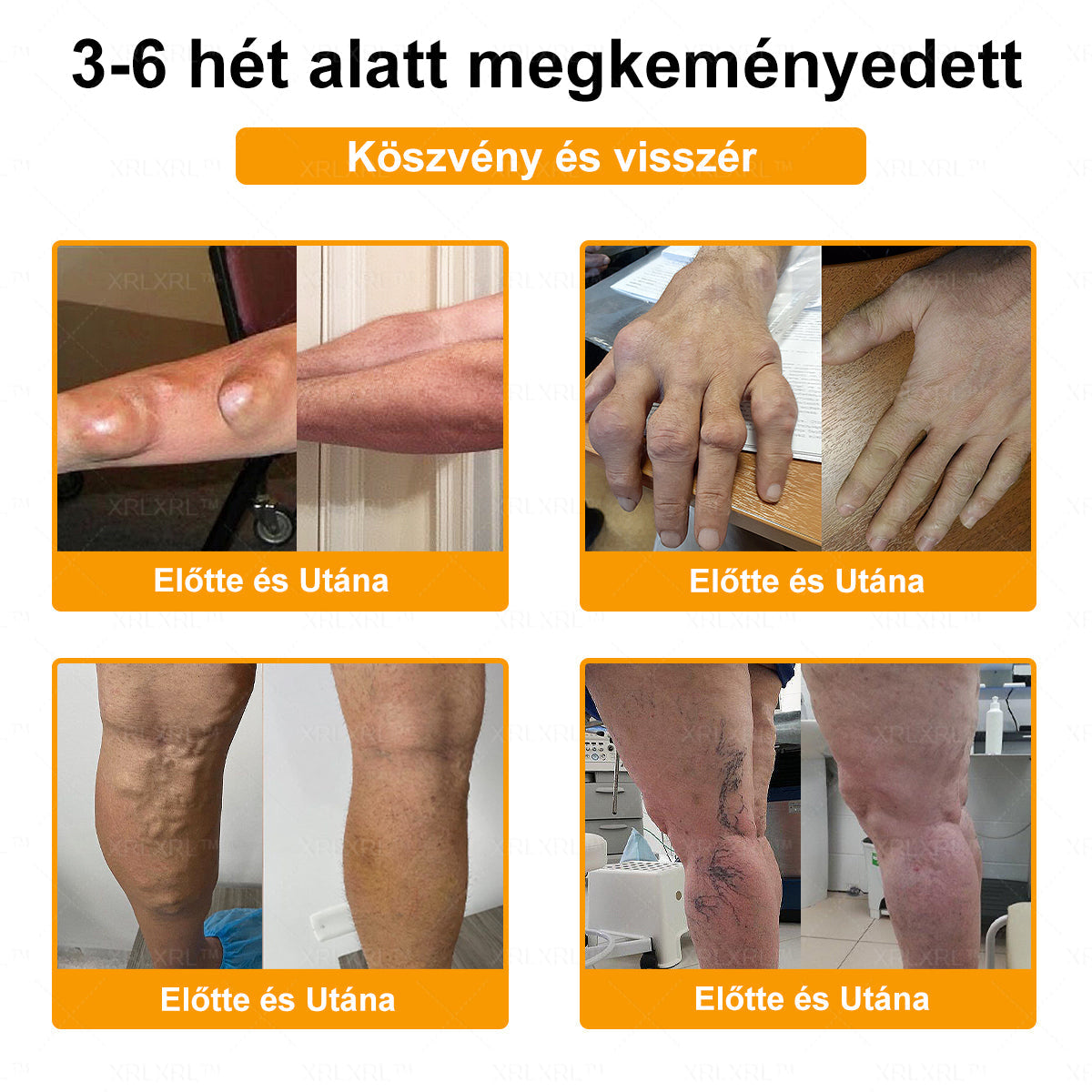 𝐗𝐑𝐋𝐗𝐑𝐋®✨ 𝐔𝐭𝐨𝐥𝐬ó 𝐞𝐬é𝐥𝐲! Szerezd meg ezt a szerencsés ajánlatot 𝟓𝟎%-os kedvezménnyel! 🎁