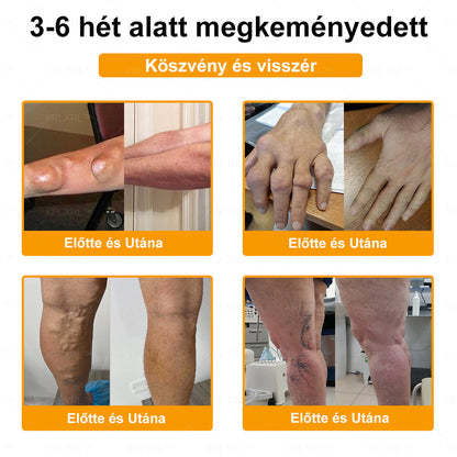 𝐗𝐑𝐋𝐗𝐑𝐋®✨ 𝐔𝐭𝐨𝐥𝐬ó 𝐞𝐬é𝐥𝐲! Szerezd meg ezt a szerencsés ajánlatot 𝟓𝟎%-os kedvezménnyel! 🎁