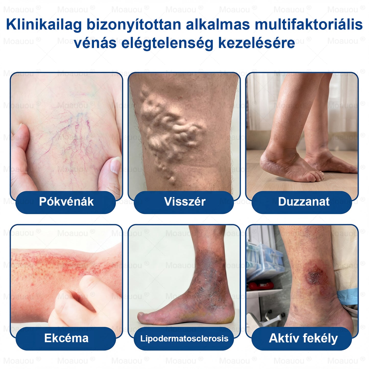 🇭🇺👨‍⚕️✅Moauou® GHK-Cu™ Mikrotűs Regeneráló Tapasz – ⚡kevesebb duzzanat, könnyebb lábak, kevésbé látható erek már 7–14 nap alatt