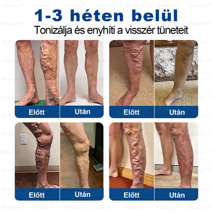 🇭🇺👨‍⚕️✅Moauou® GHK-Cu™ Mikrotűs Regeneráló Tapasz – ⚡kevesebb duzzanat, könnyebb lábak, kevésbé látható erek már 7–14 nap alatt