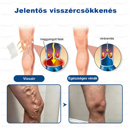 🇭🇺👨‍⚕️✅Moauou® GHK-Cu™ Mikrotűs Regeneráló Tapasz – ⚡kevesebb duzzanat, könnyebb lábak, kevésbé látható erek már 7–14 nap alatt